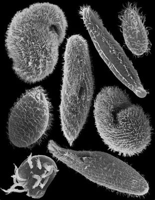  Yonacella!  A Ciliate So Small It Can Dance In Your Drinking Water